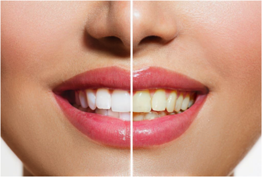 Mr Blanc Teeth PRO valgendav hambapasta (100ml)