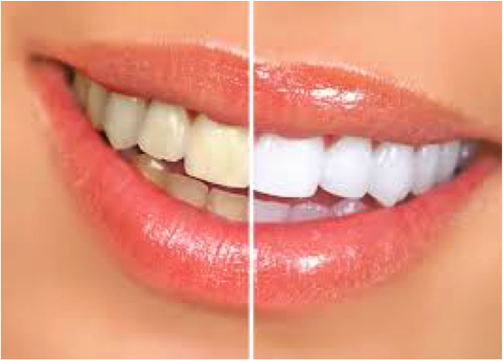 Mr Blanc Teeth pastade komplekt (2x100ml)